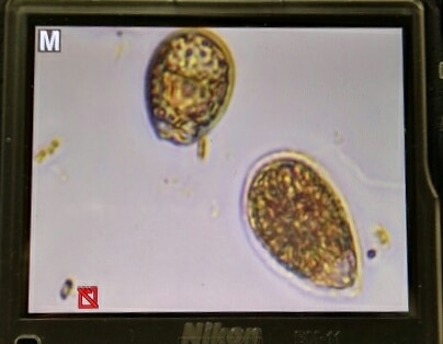 Deux cellules d’Ostreopsis ovata vues au microscope : des cellules ovales, en forme de goutte, de couleur brun doré.